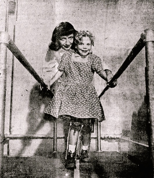 A girl wearing leg braces learns to walk with the assistance of a woman.