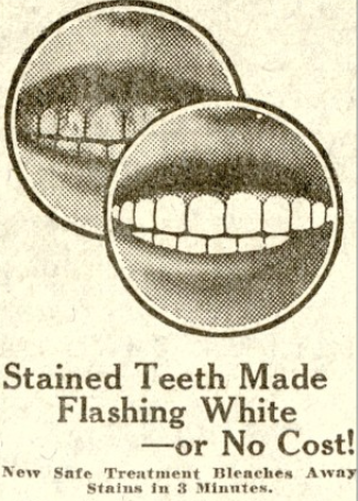 Screenshot of advertisement for tooth stain remover with smiling mouth. "Stained Teeth Made Flashing White - or no cost!"